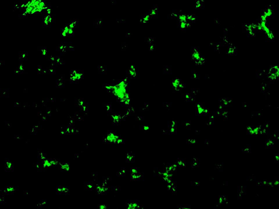 Human Neutrophil Elastase/ELA2 Alexa Fluor® 488-conjugated Antibody IC91671G