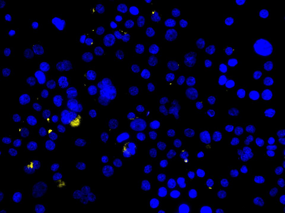 Human LC3B Alexa Fluor® 647‑conjugated Antibody IC9390R