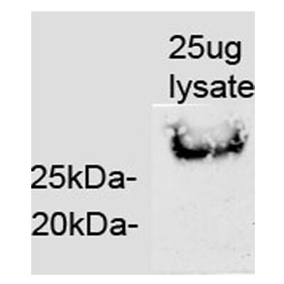eIF4E Antibody NB100-58833