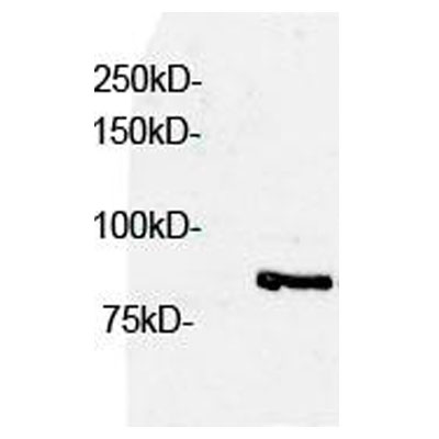 eIF4B Antibody NB100-93308