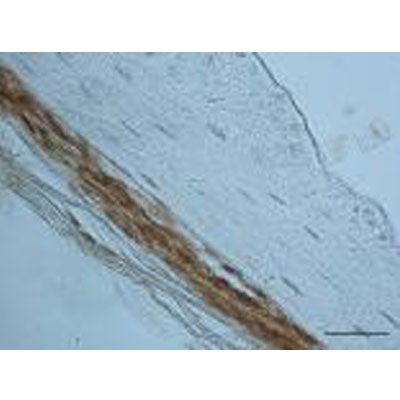 Periostin/OSF-2 Antibody - C-terminus - Azide and BSA Free NBP1-30042