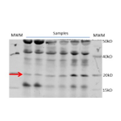 Myosin Light Chain 2 Antibody (3B2) - BSA Free NBP1-30249