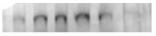 FANCD2 Antibody - BSA Free NB100-182