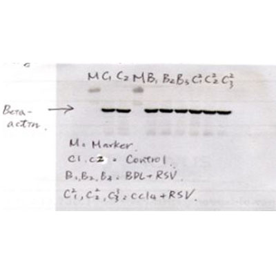beta-Actin Antibody (AC-15) NB600-501