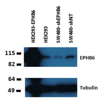 EphB6 Antibody (5D8) - Azide and BSA Free H00002051-M03