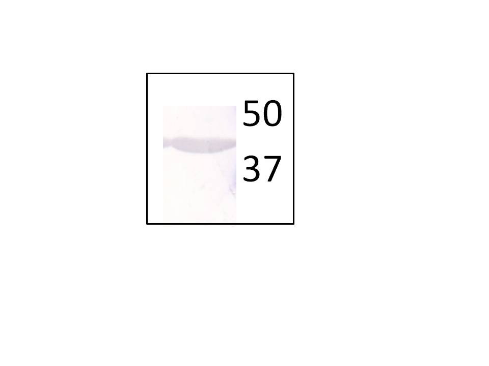 beta-Actin Antibody (AC-15) NB600-501