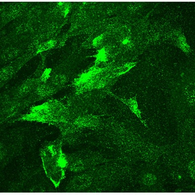NG2/MCSP Antibody NBP1-21361