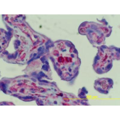 FCRN/FCGRT Antibody - BSA Free NBP1-89128