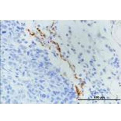 LYVE-1 Antibody - BSA Free NB100-725