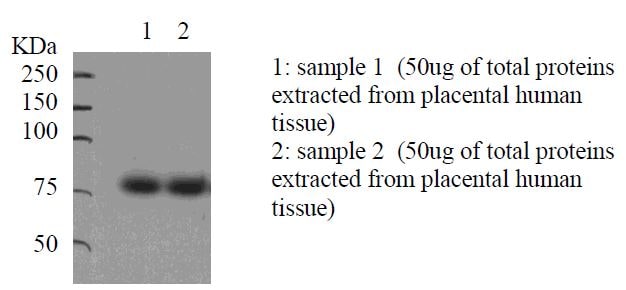 Proprotein Convertase 9/PCSK9 Antibody NB300-959