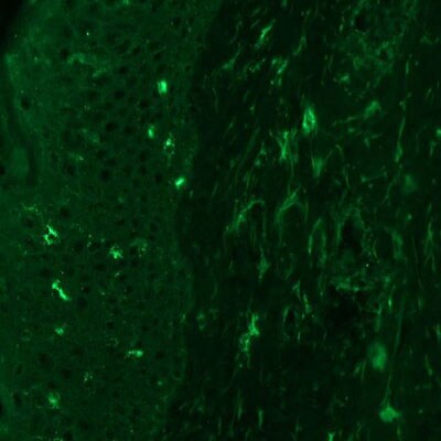 Angiopoietin-2 Antibody (MM0020-1F29) - Azide and BSA Free NB110-85467