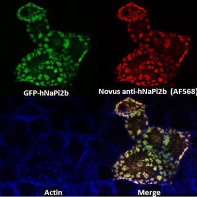 SLC34A2 Antibody - BSA Free NBP1-81013