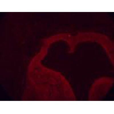 LPAR1/LPA1/EDG-2 Antibody - BSA Free NBP1-03363