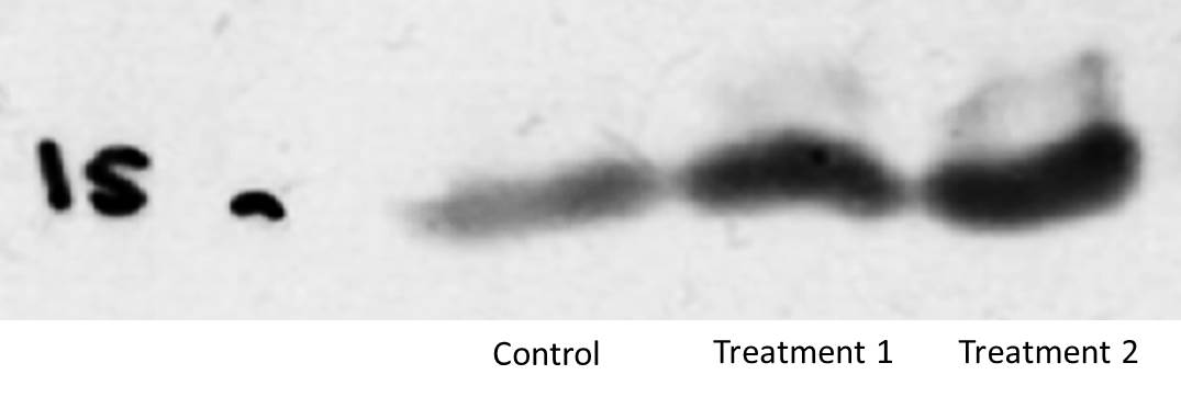 LC3B Antibody [HRP] NB100-2220H
