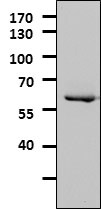 Tyrosine Hydroxylase Antibody - Azide Free NB300-109