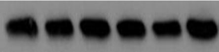alpha Tubulin Antibody (DM1A) - BSA Free NB100-690
