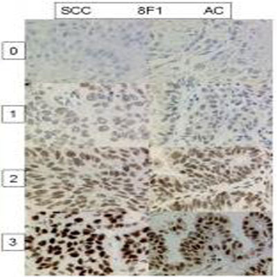 ERCC1 Antibody (8F1) - BSA Free NB500-704