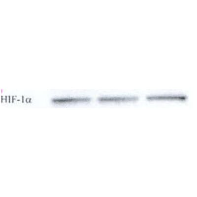 HIF-1 alpha Antibody (H1alpha67) NB100-105