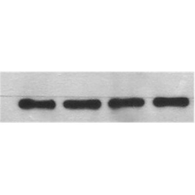beta-Actin Antibody (AC-15) NB600-501