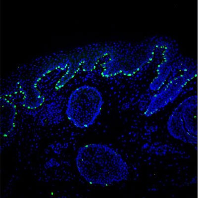 Melan-A/MART-1 Antibody (A19-P) NBP1-30151