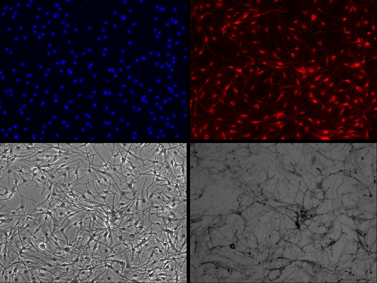 Melan-A/MART-1 Antibody (A19-P) NBP1-30151