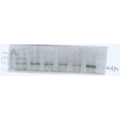 alpha Adaptin Antibody (AC1-M11) - BSA Free NB300-721
