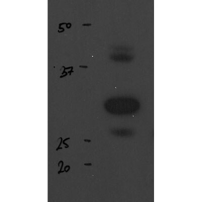 TIGAR/C12orf5 Antibody - BSA Free NBP1-49534