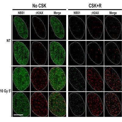 Nbs1 Antibody - BSA Free NB100-143
