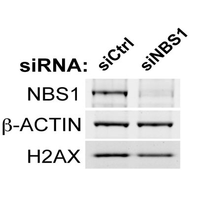 Nbs1 Antibody - BSA Free NB100-143