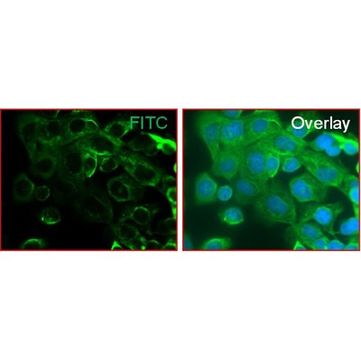 Cytokeratin, pan Antibody (PCK-26) NB120-6401