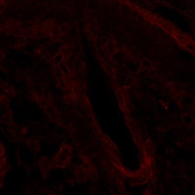 Lamin B Receptor Antibody - Azide and BSA Free H00003930-B01P
