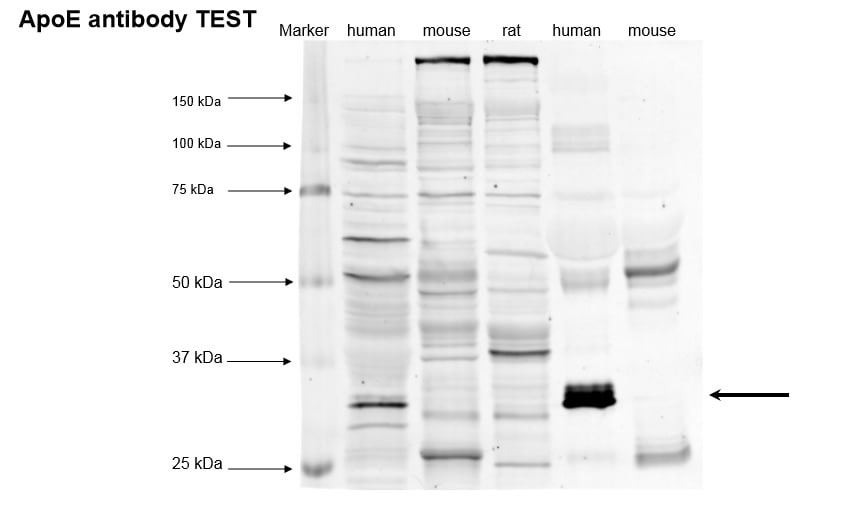Apolipoprotein E/ApoE Antibody (WUE-4) - BSA Free NB110-60531