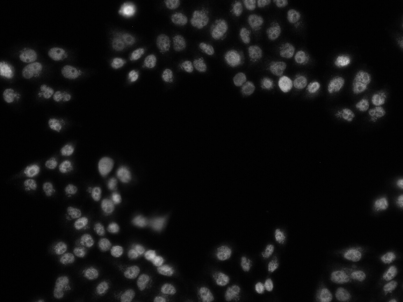 SCAF11/SFRS2IP Antibody NB100-55266