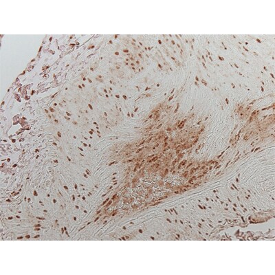 HIF-1 alpha Antibody (H1alpha67) NB100-123