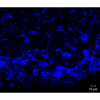 Neurokinin B Antibody - BSA Free NB300-201