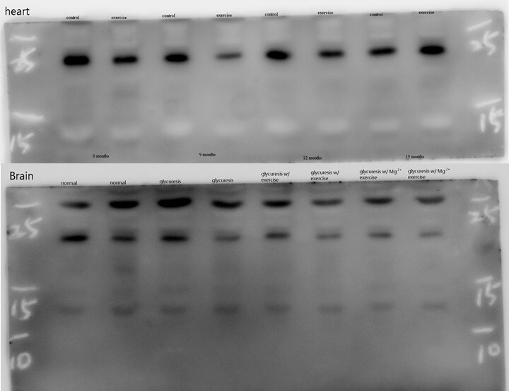 IGF-I/IGF-1 Antibody - BSA Free NBP2-16929