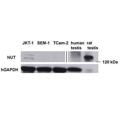 Human Testis Whole Tissue Lysate (Adult Whole Normal) NB820-59266