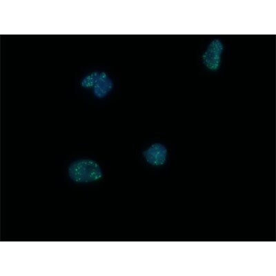 53BP1 Antibody - BSA Free NB100-904