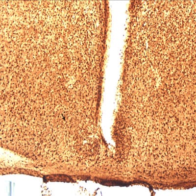 PGD2 Synthase/PTGDS Antibody - BSA Free NBP1-79280