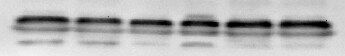 p62/SQSTM1 Antibody - BSA Free NBP1-48320