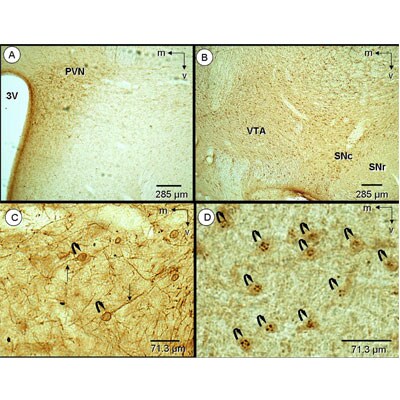 Neurokinin B Antibody - BSA Free NB300-201