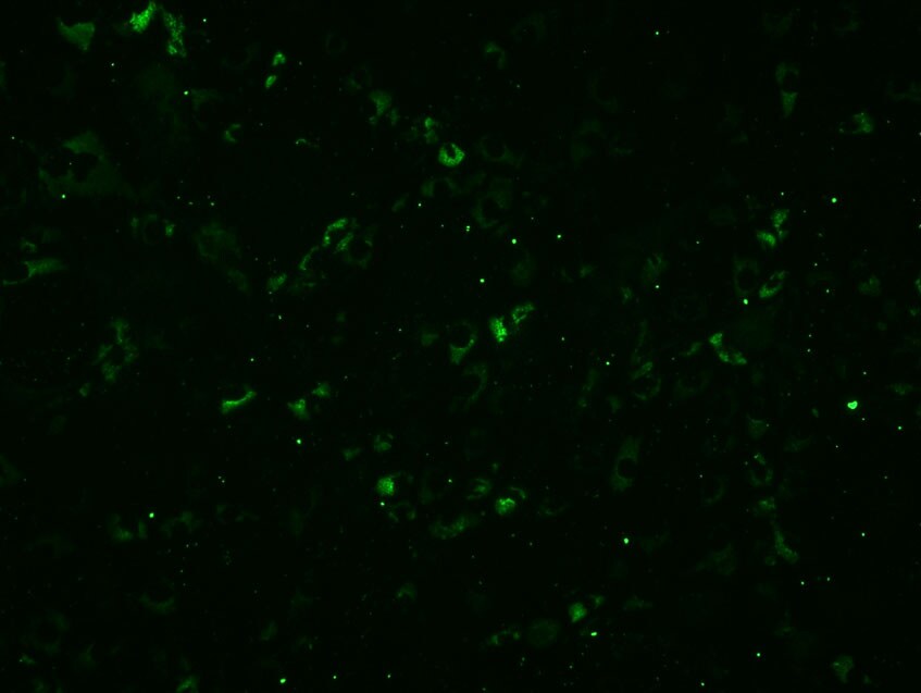 LDLR Antibody (C7) - BSA Free NBP1-78159