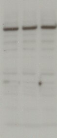 SMARCA5/SNF2H Antibody NB100-55310