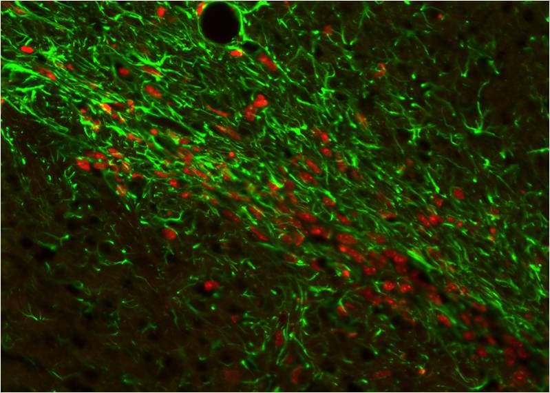 GFAP Antibody NB300-141