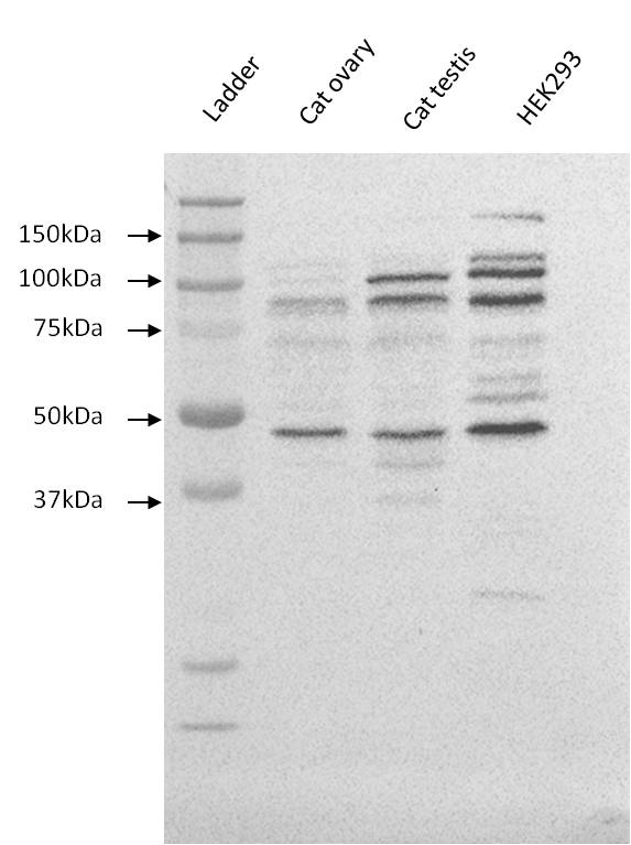 E-Cadherin Antibody (DECMA-1) NB120-11512