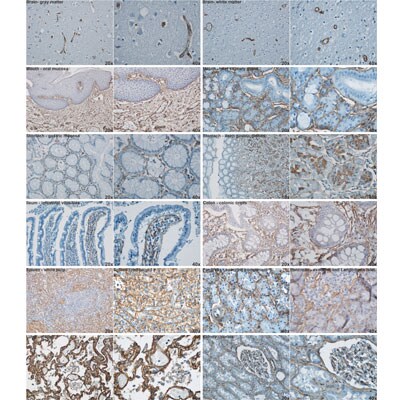Collagen IV Antibody - BSA Free NB120-6586