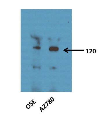 HIF-2 alpha/EPAS1 Antibody - BSA Free NB100-122
