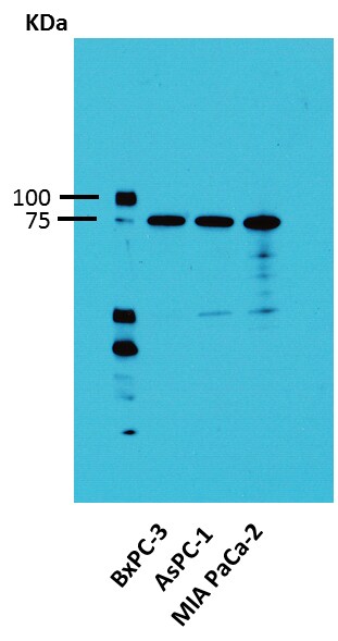 Activin RIA/ALK-2/Activin Receptor Type 1 Antibody NBP1-33500
