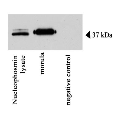 NPM1 Overexpression Lysate NBL1-13748