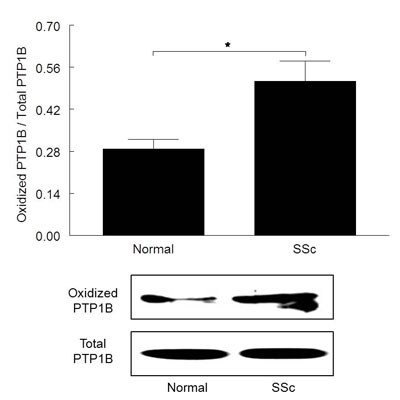 PTP1B/PTPN1 Antibody - BSA Free NBP1-28691